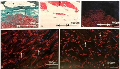图1 缺血再灌注绵羊心肌梗死模型的心肌活检