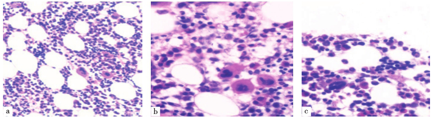 图4 骨髓活检病理（HE染色）.jpg