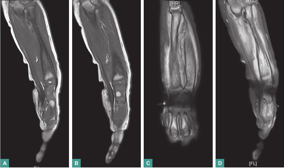 图3 左手MRI.jpg