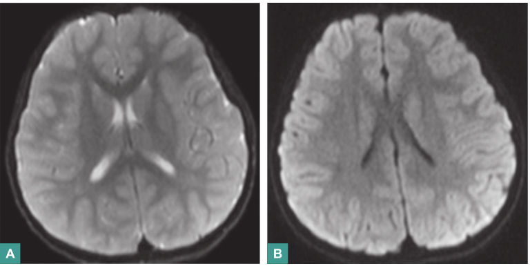 图1 颅脑MRI.jpg